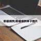 新疆病例/新疆病例单子图片